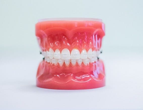 florissant orthodontics