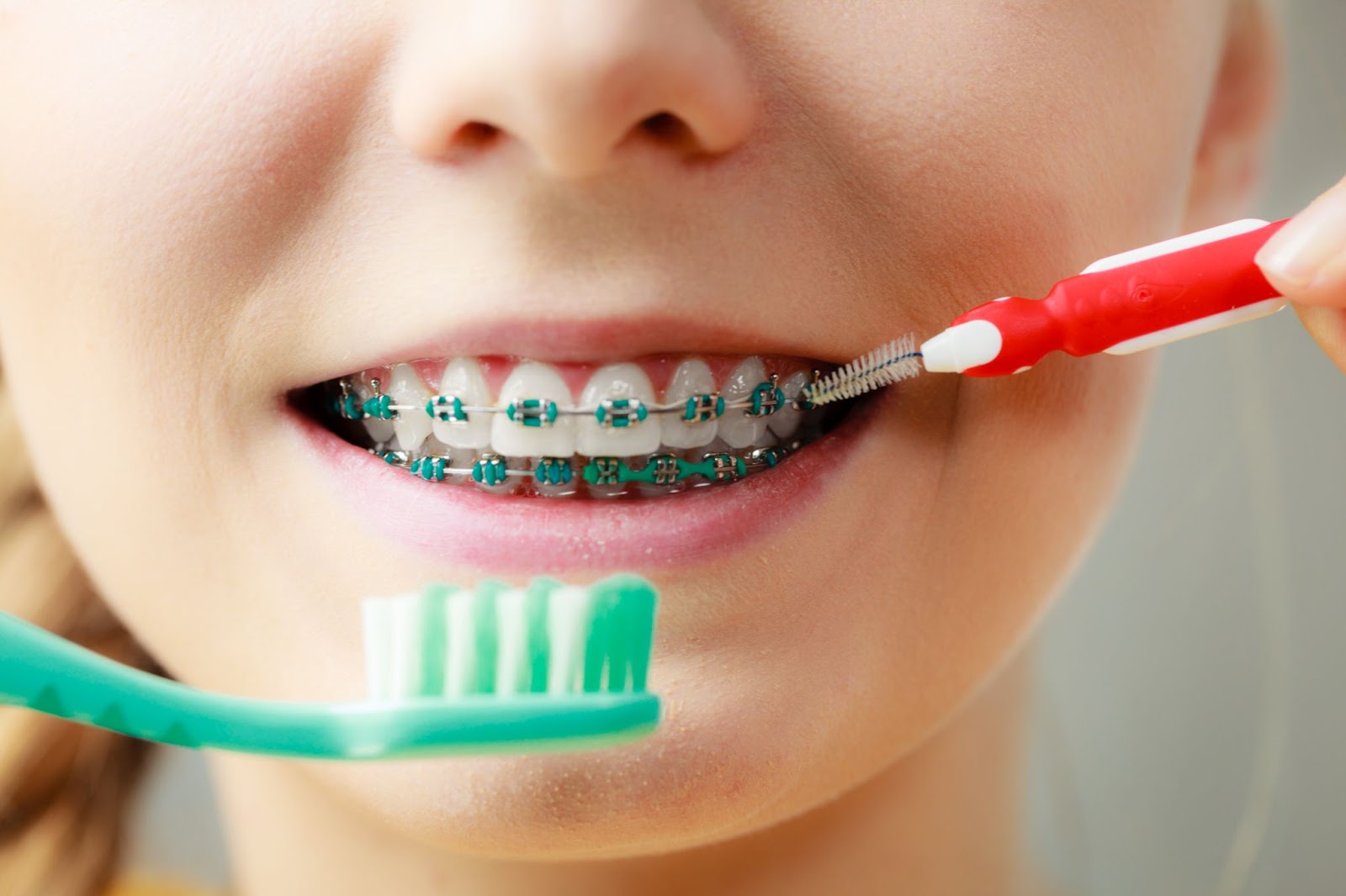 Orthodontic Tips for School Success